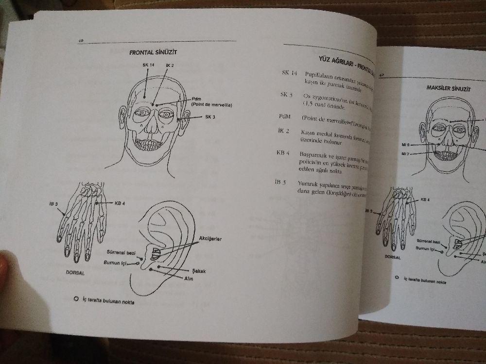 Tp Kitaplar Satlk Akupunktur la arl hastalklarn tedavisi